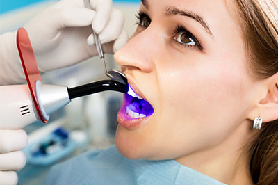 dental bonding in Ocean Township