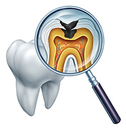 Ocean Township Tooth Decay