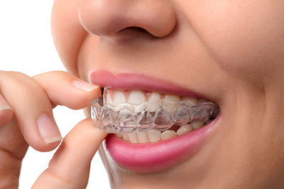 invisalign in Ocean Township