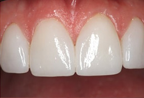 Dental Photos in Ocean Township